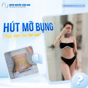 Bác Sĩ Thẩm Mỹ Nguyễn Tuấn Anh – Bác sĩ chuyên khoa hút mỡ uy tín