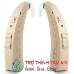 MÁY TRỢ THÍNH MOTION SP 3 PX