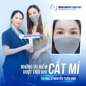 Những ưu điểm vượt trội khi cắt mí tại BVTM Nguyễn Tuấn Anh