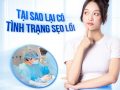 Nguyên nhân gây nên sẹo lồi sau nâng mũi