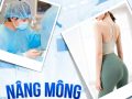 Quy trình nâng vòng 3 tại BVTM Nguyễn Tuấn Anh