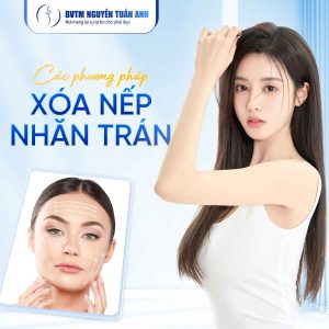 Các phương pháp căng da trán phổ biến hiện nay